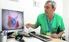 El Macarena ensaya nuevas terapias contra el melanoma